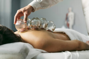 best cupping therapy