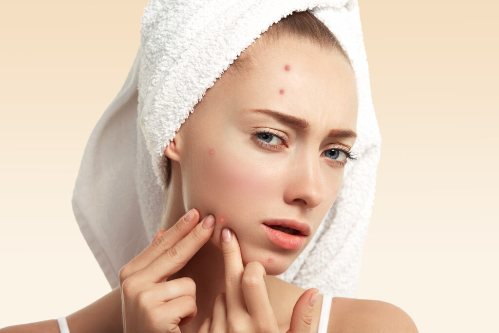 Banishing Blemishes: Effective Tips for Pimple Treatment